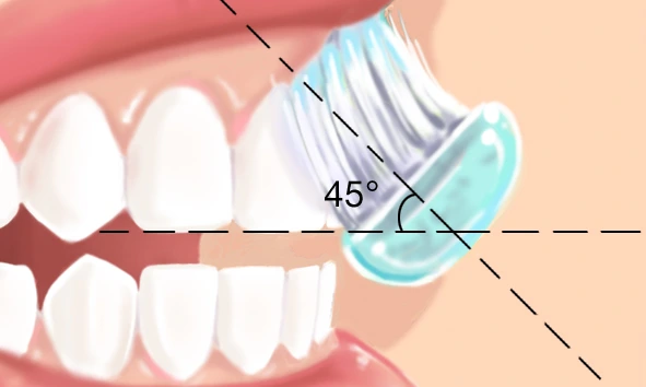 Technique brossage des dents  2